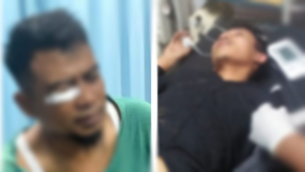 Lakukan Peliputan Di SPBU Bungo, 2 Wartawan Diduga Di Aniaya OTK