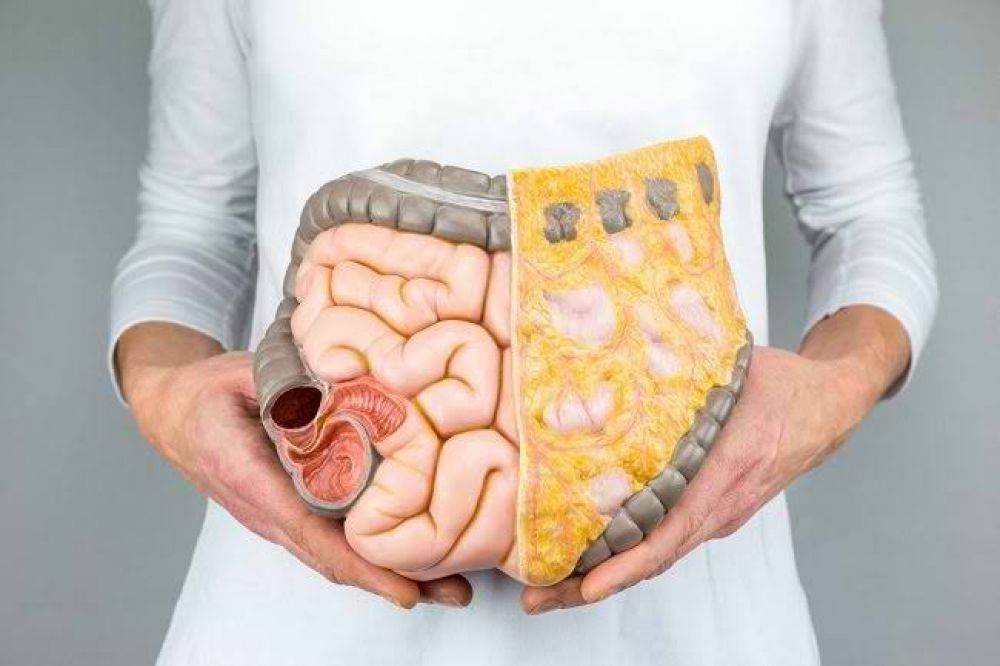 7 Cara Membersihkan Usus Yang Kotor Supaya Sehat, Patut Dicoba Nih..