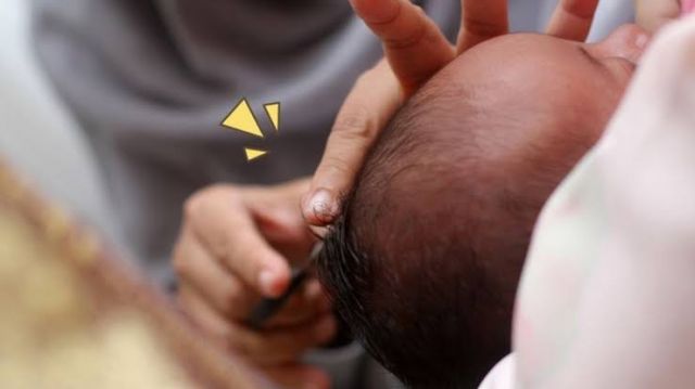 Sudah Dewasa, Apa Masih Perlu Di Aqiqohi?